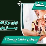 بنر آموزشی کلینیک لیزر شفا با عنوان سرطان مقعد چیست همراه با ماکت آناتومی پزشکی