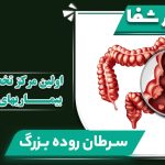 مایش شماتیک تومور در روده بزرگ و رکتوم برای تشخیص سرطان کولورکتال